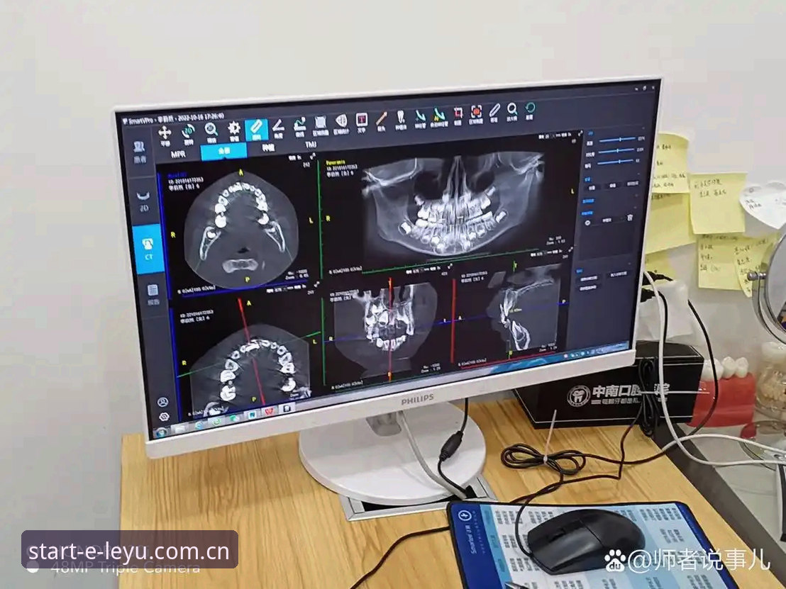 乐鱼cn旧版数据修复 乐鱼CN旧版数据修复完成,v3.0升级后赛事赔付更新效率提升40%